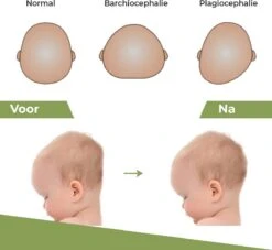 Novalits - Orthopedisch Baby Zijslaapkussen Met Traagschuim En Anti-Allergene Bamboe Microvezel Stof Om Een Plat Hoofd Tegen Te Gaan - Zijligkussen Voor Peuter - Babykussen Zijligging - Rolkussen - Steunkussen - Slaapondersteuning 16 Novalits - Orthopedisch Baby Zijslaapkussen Met Traagschuim En Anti-Allergene Bamboe Microvezel Stof Om Een Plat Hoofd Tegen Te Gaan - Zijligkussen Voor Peuter - Babykussen Zijligging - Rolkussen - Steunkussen - Slaapondersteuning -Bekend Babyproducten Winkel 1200x1103 4